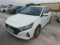 preview Hyundai i20 #0